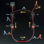 High-power hybrid laser emitter to permeate deep into the skin