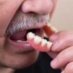 Dental problems have ‘compounding effect’ on older people’s lives, experts warn