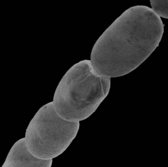 Biggest germs which is noticeable to the naked eye found