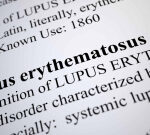 Researchers exposed the molecular system for the biggest lupus hereditary threat element