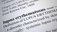 Researchers exposed the molecular system for the biggest lupus hereditary threat element