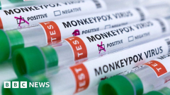 LGBT groups need more action on monkeypox