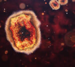 Mpox (குரங்கு நோய்): அறிகுறிகள், படங்கள், சிகிச்சைகள் மற்றும் தடுப்பூசிகள்