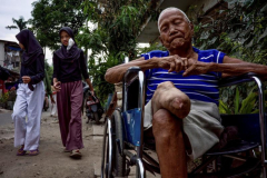 Indonesian leprosy survivor crafts brand-new limbs for avoided villagers