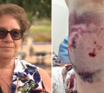Adelaide granny trampled by pet in regional park
