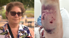 Adelaide granny trampled by pet in regional park