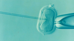 A unique approach to select muchhealthier sperm for Successful IVF
