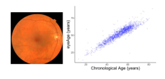 Google scientists established an aging clock utilizing deep knowing on retinal images