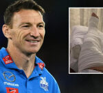 Brent Harvey concerns upgrade on his damaged leg after AFL legend made to wait one hour for ambulance