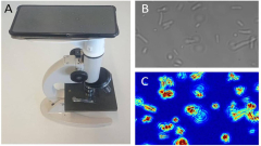 Transforming antibiotic resistance screening: A basic, economical, and fast technique