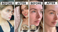 Viral TikTok video with 10m views exposes jaw-dropping secret behind Silvi silk pillowcase hailed for changing skin