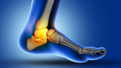 Advancement: Scientists determined the degree to which a bone fracture can lead to early death