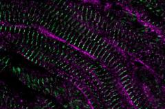 Comprehending the system of heart regrowth in Zebrafish