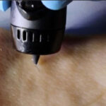 A wound-healing ink can be 3D printed into cuts to recover injuries