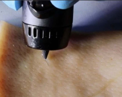 A wound-healing ink can be 3D printed into cuts to recover injuries