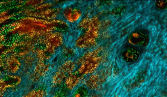 Skin cells work together to battle cancer