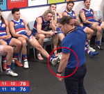 Luke Beveridge’s broken hand exposed after furious punch throughout loss to Sydney Swans