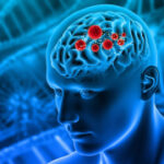 Accuracy brain cancer elimination with the body’s unnoticeable scalpel