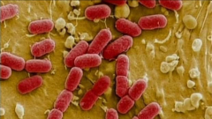 E. coli breakout linked to Calgary daycares sendsout up to 50 kids to medicalfacility