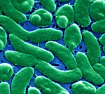 CDC problems caution over flesh-eating germs killing Americans