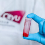 CityU’s cutting-edge photo-oxidation treatment for cancer