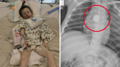 Victorian household’s 6 months of pain priorto finding small battery was behind child’s illness