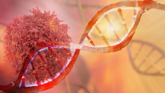 11 genes connected to aggressive prostate cancer anomalies