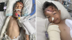 Mom of eight-year-old Melbourne kid seriously hurt when struck by automobile in Braybrook breaks silence