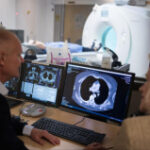 Immune system aging noticeable through CT scan
