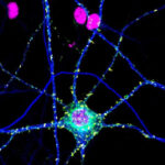 Unanticipated link inbetween schizophrenia threat proteins