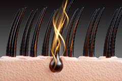 Researchers effectively 3D-printed hair hairfollicles
