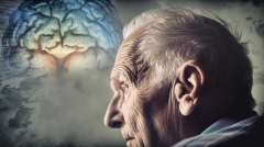 Neuroinflammation’s secret function in Alzheimer’s exposed