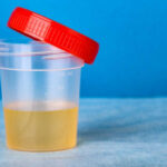 Researchers found an enzyme accountable for making urine yellow