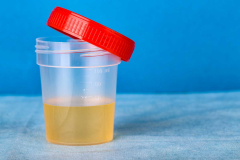 Researchers found an enzyme accountable for making urine yellow