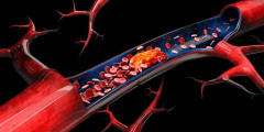 New signaling path reveals atherosclerosis insights