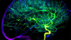 Improved arterial connections assistance in stroke healing