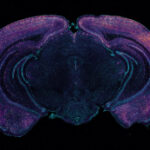 Gamma rhythm stimulation: Clearing Amyloid in Alzheimer’s mice