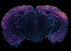 Gamma rhythm stimulation: Clearing Amyloid in Alzheimer’s mice