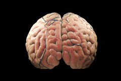 Larger human brains deal a protective impact versus dementia