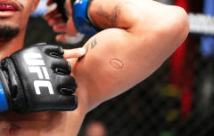 Video: Should Igor Severino get a 2nd opportunity after UFC biting occurrence led to release?