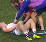 Cody Weightman suffers gruesome elbow injury for the 3rd time in 2 years