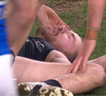 Concussion drama as Harry McKay beats HIA and North Melbourne