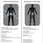 What is stereotactic radiation treatment for prostate cancer? How does it compare to other treatments?