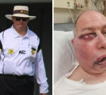 Perth cricket umpire suffers gruesome injury throughout third-grade WASTCA match