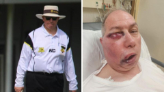 Perth cricket umpire suffers gruesome injury throughout third-grade WASTCA match