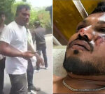 Air India crash sole survivor Vishwash Kumar Ramesh speaks about escape in airliner tragedy which killed hundreds