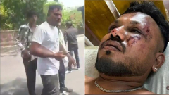 Air India crash sole survivor Vishwash Kumar Ramesh speaks about escape in airliner tragedy which killed hundreds