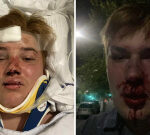 Jack thought he was meeting a man for a date. Instead, he was viciously gay bashed by eight youths in an Aussie city