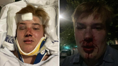 Jack thought he was meeting a man for a date. Instead, he was viciously gay bashed by eight youths in an Aussie city