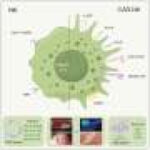 Universal stem cells reset immunity in a systemic sclerosis patient
